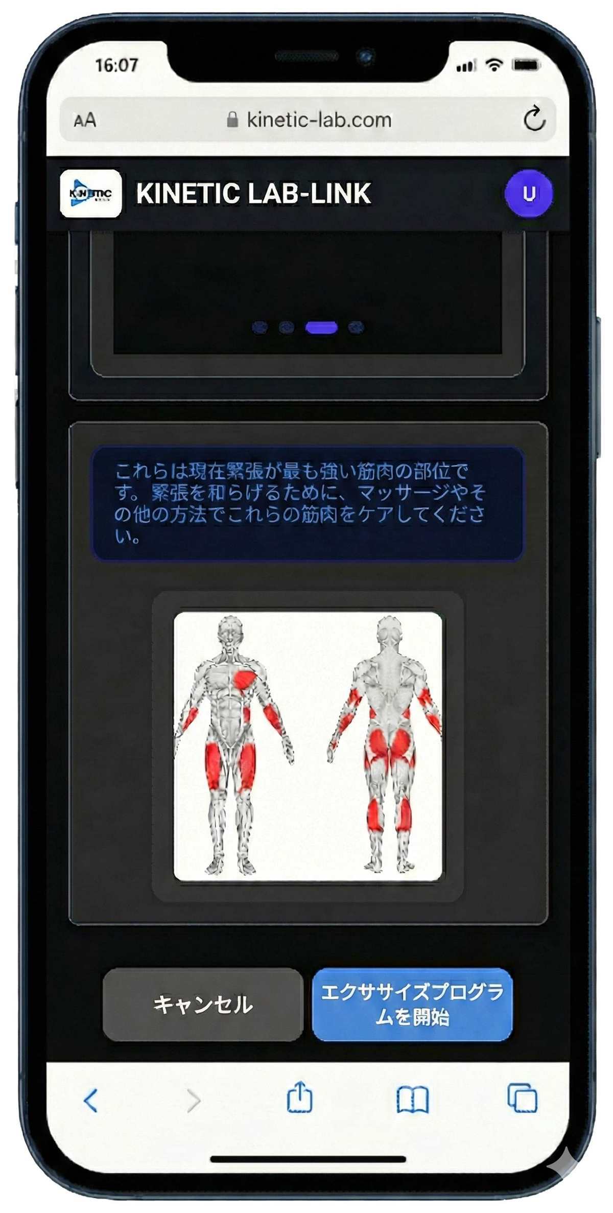 BCバランス療法